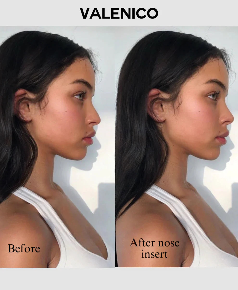 6Pc/Set Nose Shaping Insert